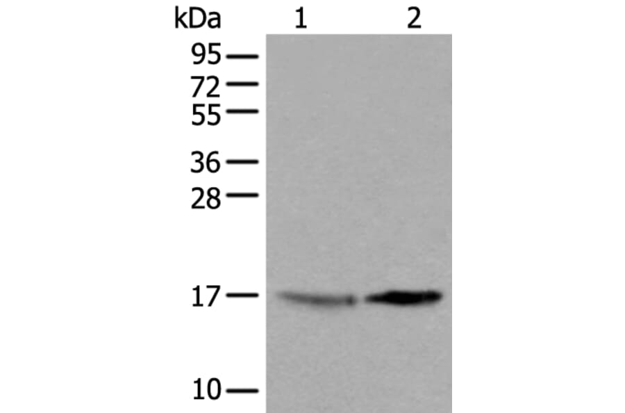UBE2W Antibody from Signalway Antibody (43601) - Antibodies.com