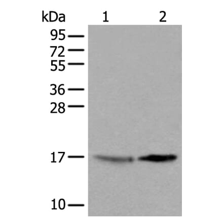 UBE2W Antibody from Signalway Antibody (43601) - Antibodies.com