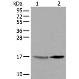 UBE2W Antibody from Signalway Antibody (43601) - Antibodies.com