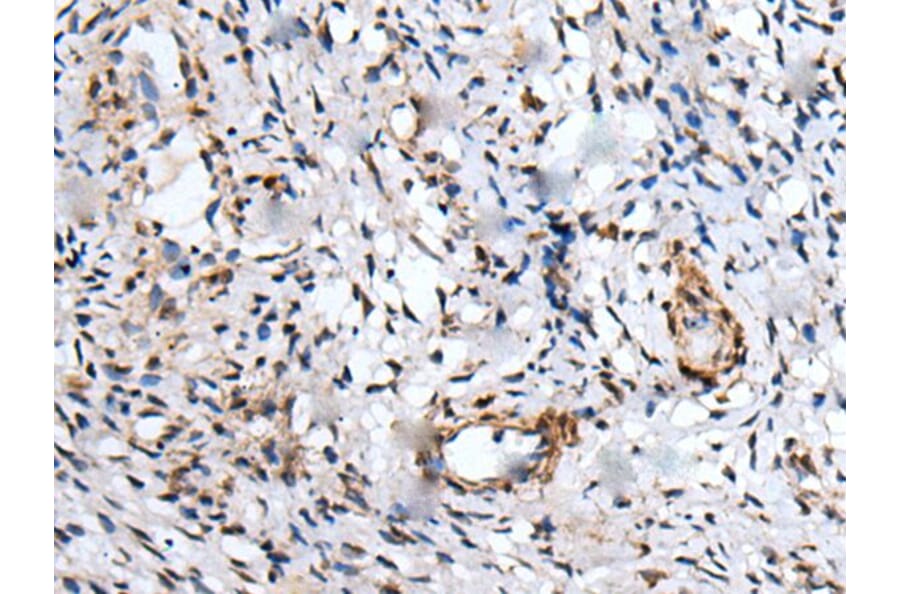 UBE2W Antibody from Signalway Antibody (43601) - Antibodies.com