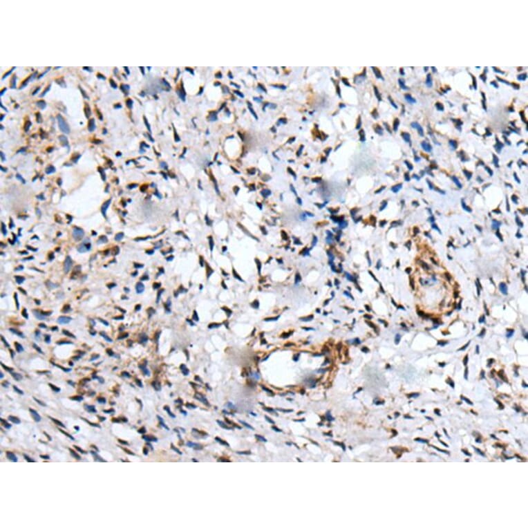 UBE2W Antibody from Signalway Antibody (43601) - Antibodies.com