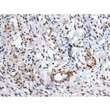 UBE2W Antibody from Signalway Antibody (43601) - Antibodies.com
