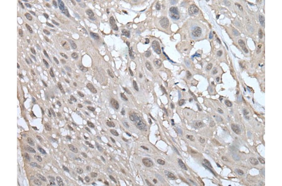 UBE2W Antibody from Signalway Antibody (43601) - Antibodies.com