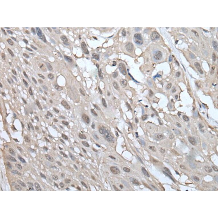 UBE2W Antibody from Signalway Antibody (43601) - Antibodies.com