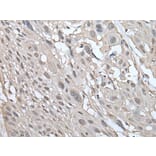 UBE2W Antibody from Signalway Antibody (43601) - Antibodies.com