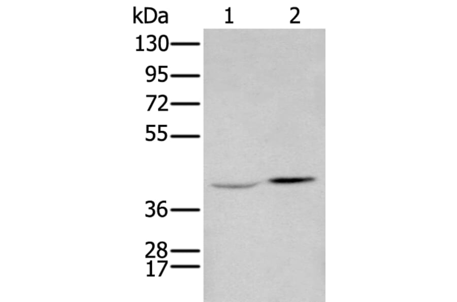 HOXA2 Antibody from Signalway Antibody (43685) - Antibodies.com