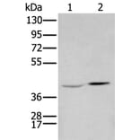 HOXA2 Antibody from Signalway Antibody (43685) - Antibodies.com