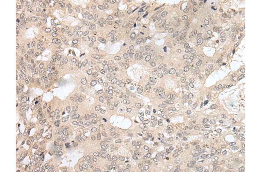 HOXA2 Antibody from Signalway Antibody (43685) - Antibodies.com