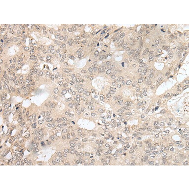 HOXA2 Antibody from Signalway Antibody (43685) - Antibodies.com