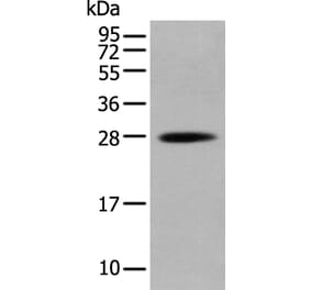 HOXB6 Antibody from Signalway Antibody (43686) - Antibodies.com