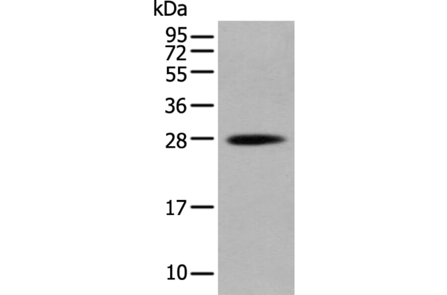 HOXB6 Antibody from Signalway Antibody (43686) - Antibodies.com
