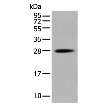 HOXB6 Antibody from Signalway Antibody (43686) - Antibodies.com