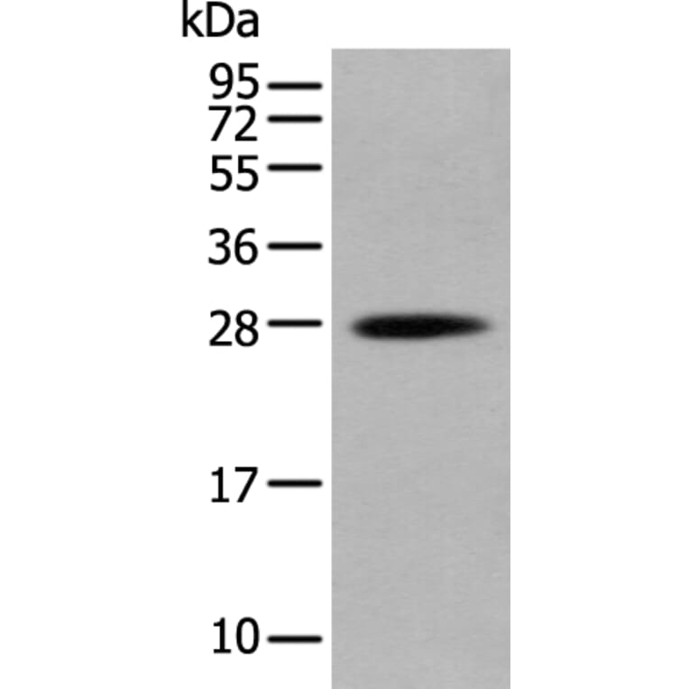 HOXB6 Antibody from Signalway Antibody (43686) - Antibodies.com