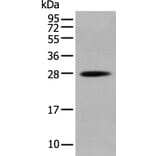HOXB6 Antibody from Signalway Antibody (43686) - Antibodies.com