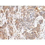 HOXB6 Antibody from Signalway Antibody (43686) - Antibodies.com