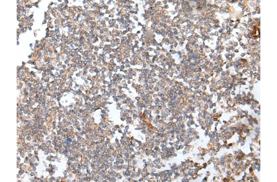 HOXB6 Antibody from Signalway Antibody (43686) - Antibodies.com