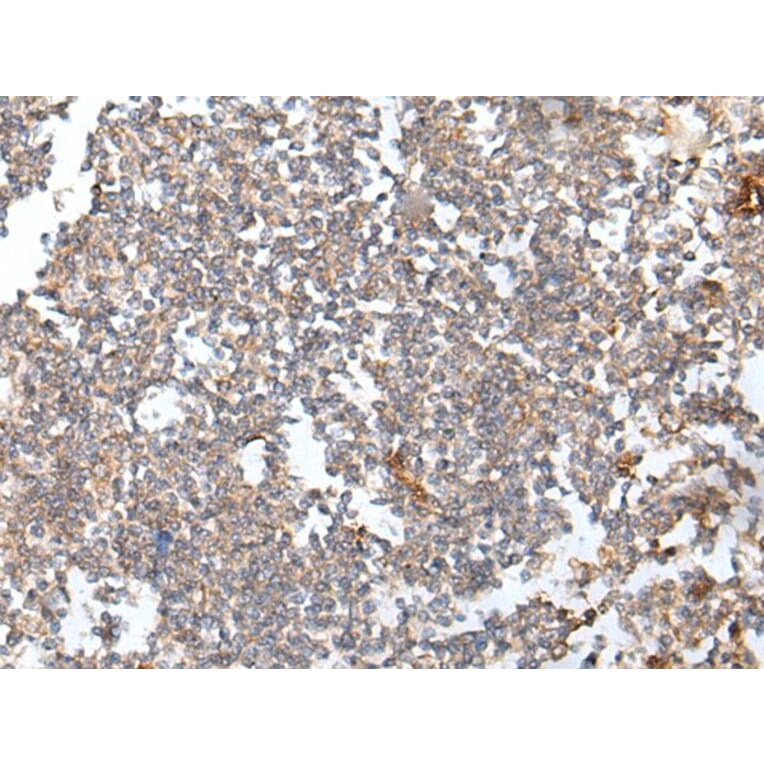 HOXB6 Antibody from Signalway Antibody (43686) - Antibodies.com