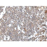 HOXB6 Antibody from Signalway Antibody (43686) - Antibodies.com