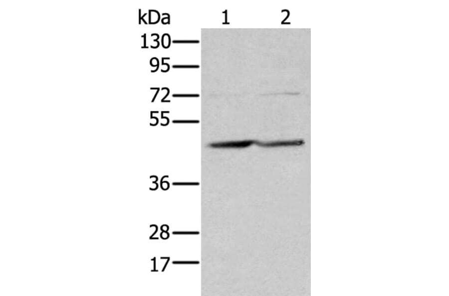 EFNB3 Antibody from Signalway Antibody (43704) - Antibodies.com