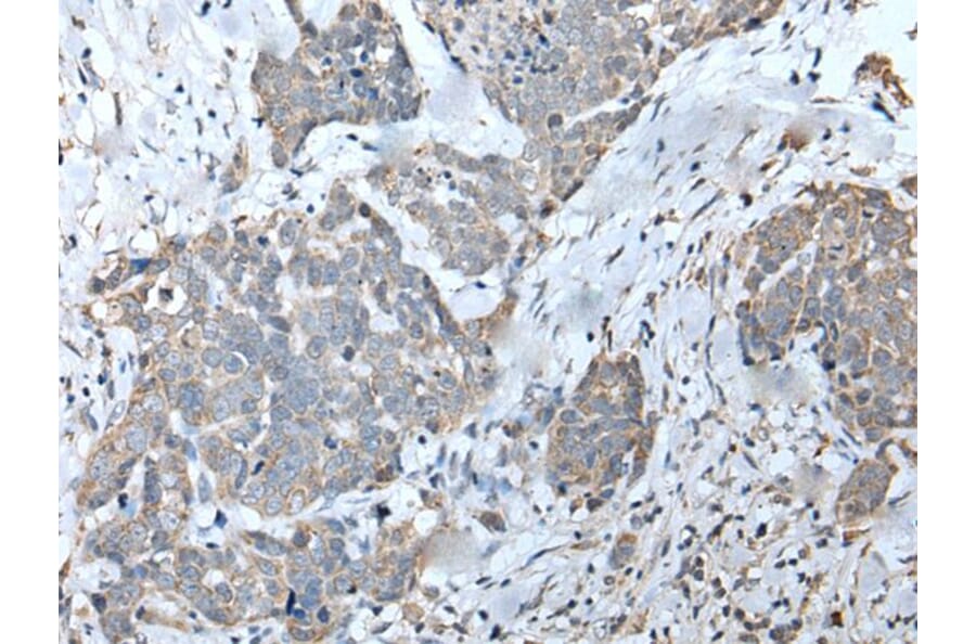 EFNB3 Antibody from Signalway Antibody (43704) - Antibodies.com