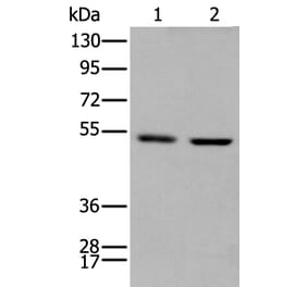 PTOV1 Antibody from Signalway Antibody (43710) - Antibodies.com