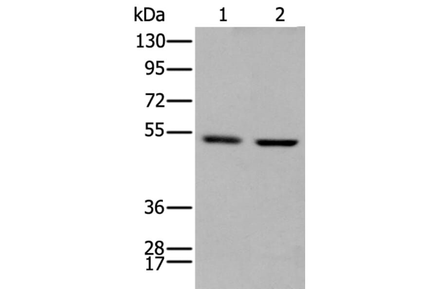 PTOV1 Antibody from Signalway Antibody (43710) - Antibodies.com
