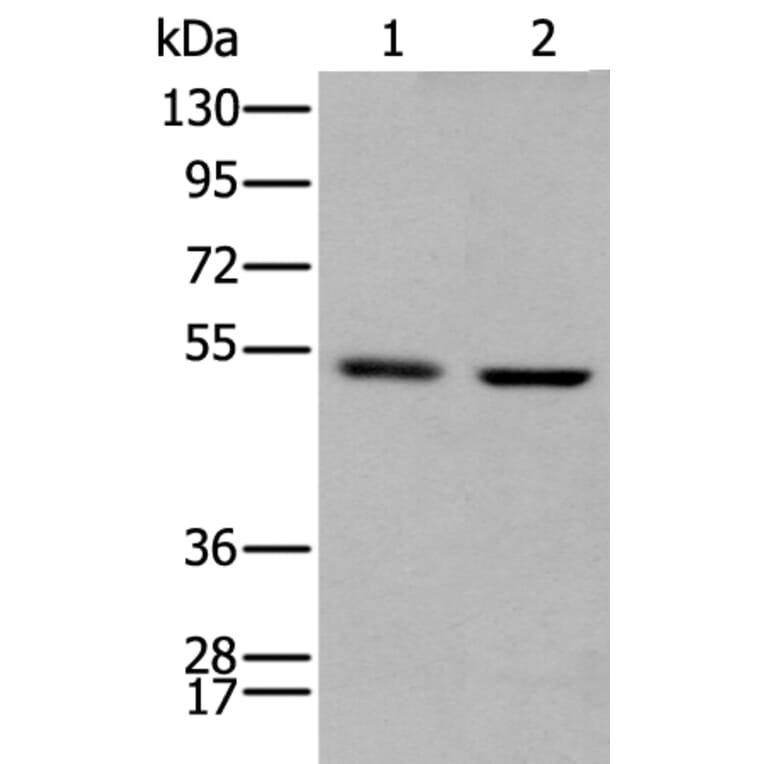 PTOV1 Antibody from Signalway Antibody (43710) - Antibodies.com
