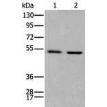 PTOV1 Antibody from Signalway Antibody (43710) - Antibodies.com