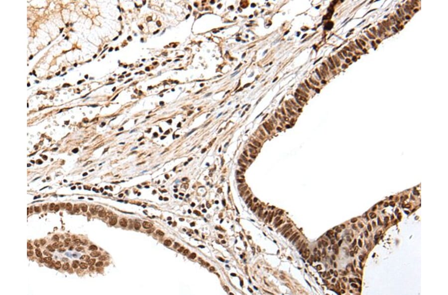 PTOV1 Antibody from Signalway Antibody (43710) - Antibodies.com