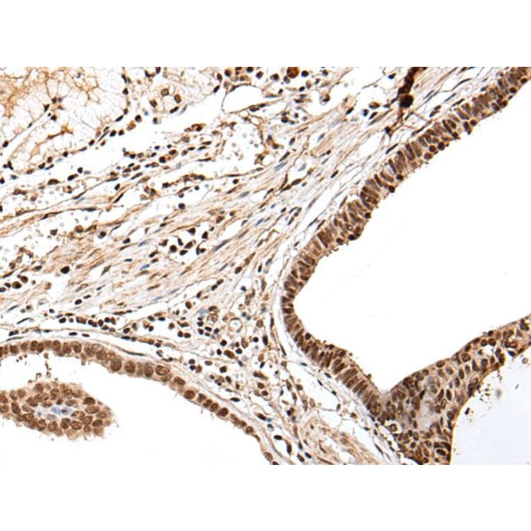 PTOV1 Antibody from Signalway Antibody (43710) - Antibodies.com