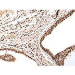 PTOV1 Antibody from Signalway Antibody (43710) - Antibodies.com
