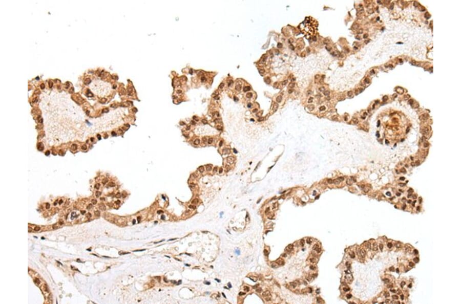 PTOV1 Antibody from Signalway Antibody (43710) - Antibodies.com