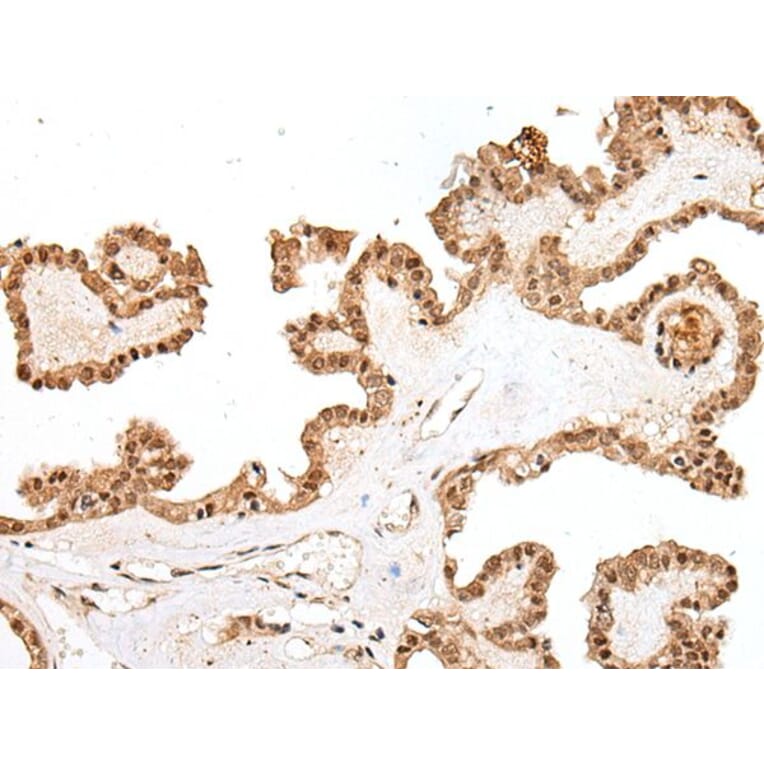 PTOV1 Antibody from Signalway Antibody (43710) - Antibodies.com
