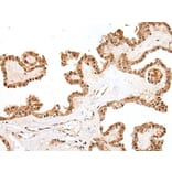 PTOV1 Antibody from Signalway Antibody (43710) - Antibodies.com