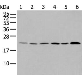 DUSP3 Antibody from Signalway Antibody (43721) - Antibodies.com
