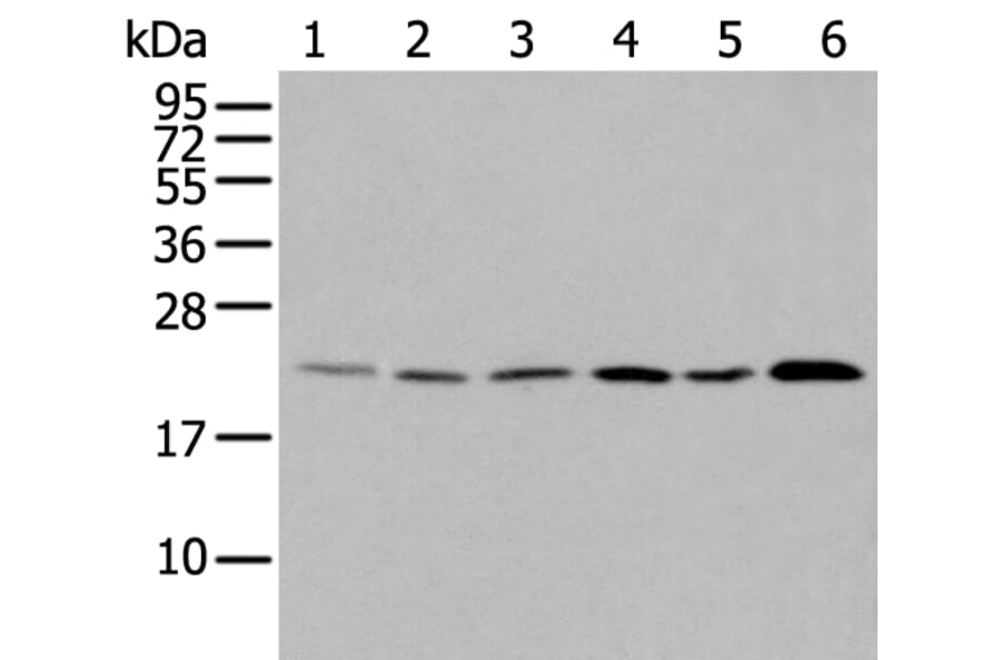 DUSP3 Antibody from Signalway Antibody (43721) - Antibodies.com