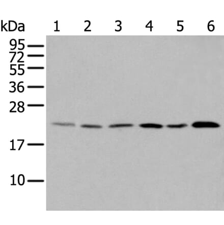 DUSP3 Antibody from Signalway Antibody (43721) - Antibodies.com