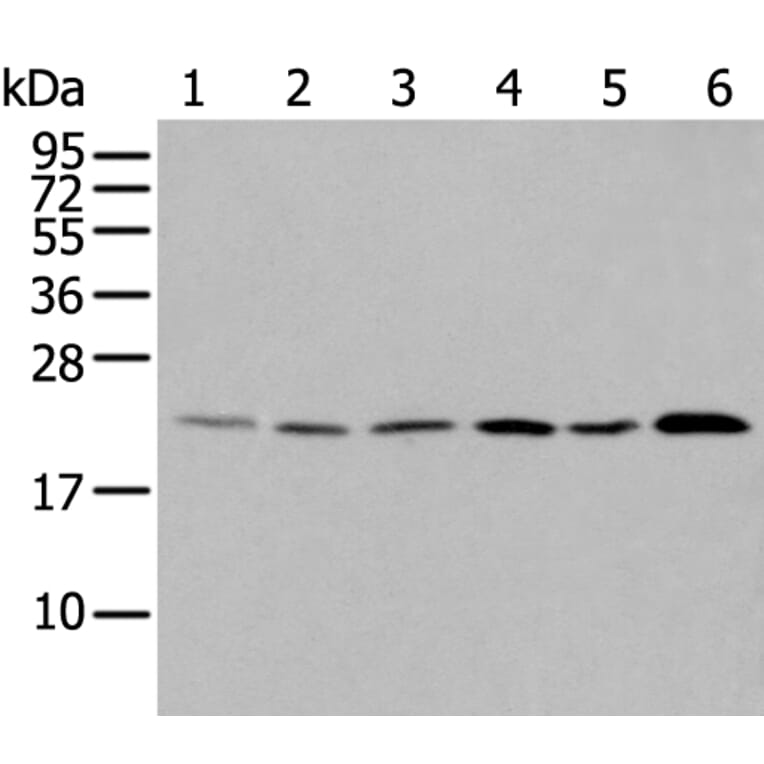 DUSP3 Antibody from Signalway Antibody (43721) - Antibodies.com