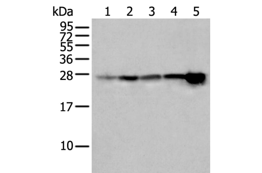 HSPB1 Antibody from Signalway Antibody (43733) - Antibodies.com
