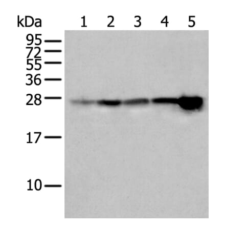 HSPB1 Antibody from Signalway Antibody (43733) - Antibodies.com