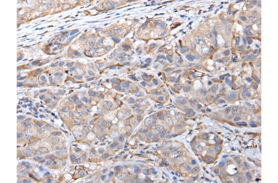 HSPB1 Antibody from Signalway Antibody (43733) - Antibodies.com