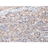 HSPB1 Antibody from Signalway Antibody (43733) - Antibodies.com