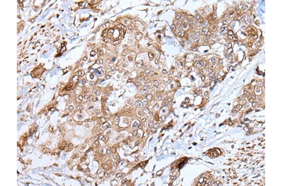 HSPB1 Antibody from Signalway Antibody (43733) - Antibodies.com