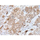 HSPB1 Antibody from Signalway Antibody (43733) - Antibodies.com
