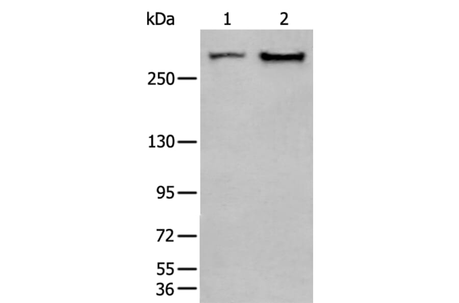 SPTA1 Antibody from Signalway Antibody (43755) - Antibodies.com