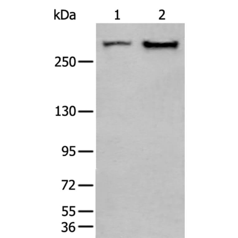 SPTA1 Antibody from Signalway Antibody (43755) - Antibodies.com
