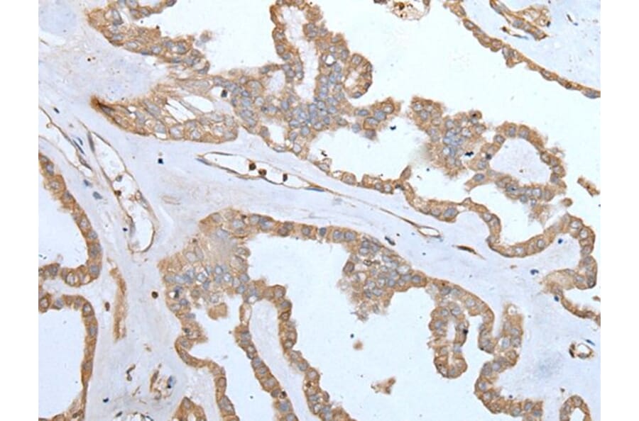 SPTA1 Antibody from Signalway Antibody (43755) - Antibodies.com