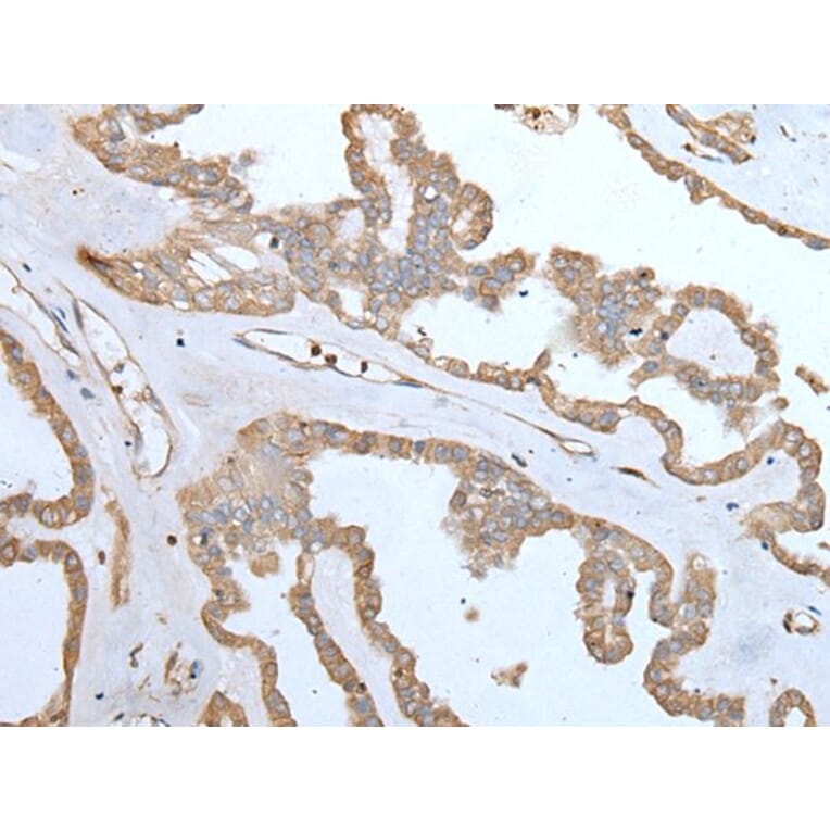 SPTA1 Antibody from Signalway Antibody (43755) - Antibodies.com
