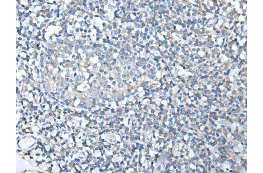 SPTA1 Antibody from Signalway Antibody (43755) - Antibodies.com
