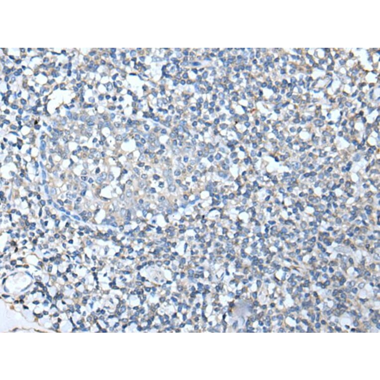 SPTA1 Antibody from Signalway Antibody (43755) - Antibodies.com